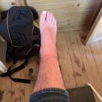 Mosquitos en el Tayrona y alrededores