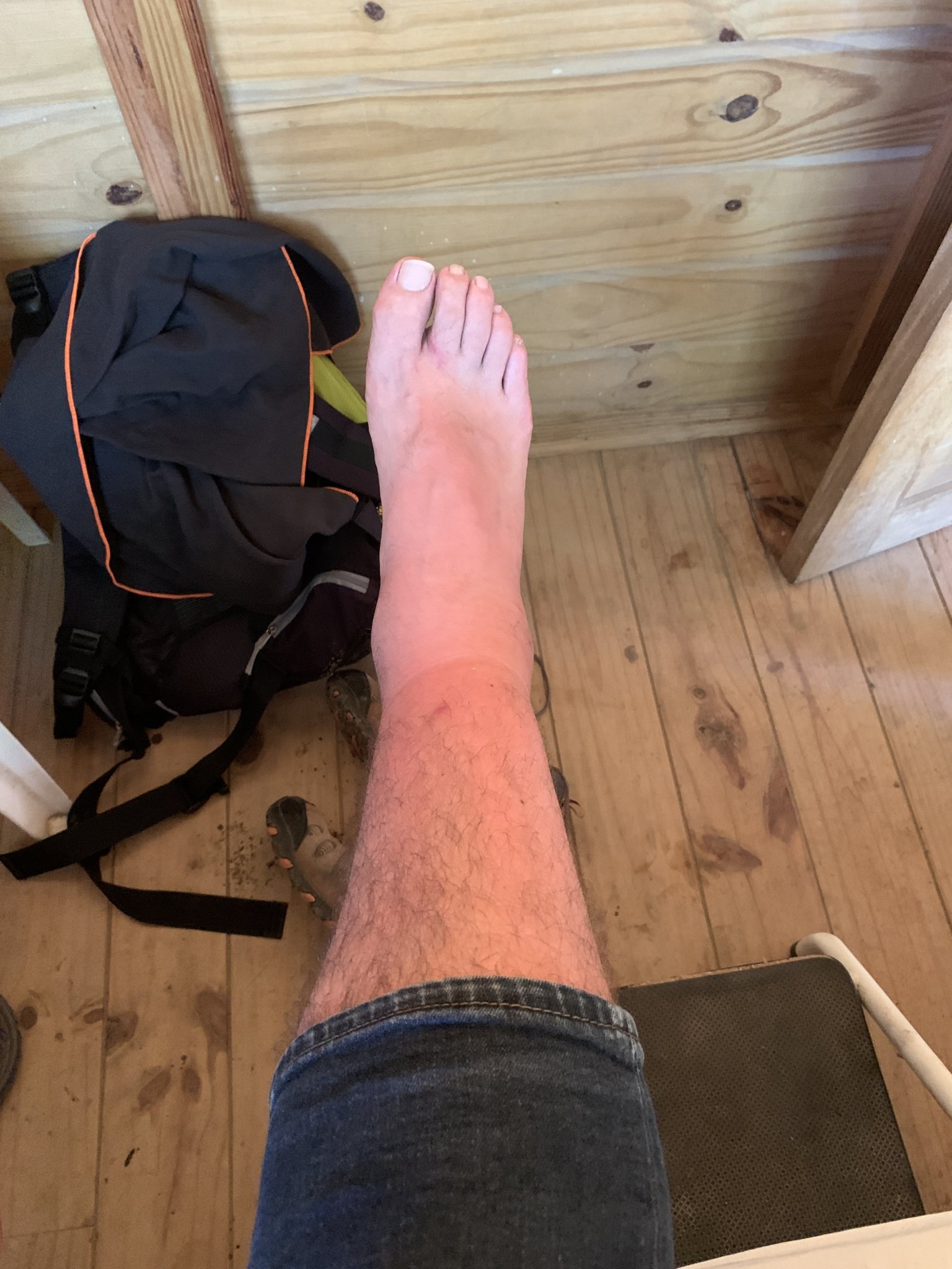 Mosquitos en el Tayrona y alrededores Mosquitos en el Tayrona y alrededores